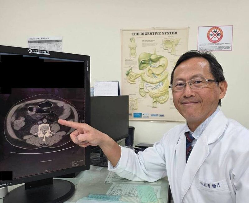 苗栗黃姓男子長期便秘經常自行灌腸，因力道過猛造成直腸破裂，引發嚴重腹膜炎。大千醫院外科部主任馮啟彥（圖）27日提醒，灌腸應在醫師指示下謹慎使用且不宜長期依賴，改善便秘仍應從改善生活、飲食習慣著手。（大千醫院提供）中央社記者管瑞平傳真　114年11月27日