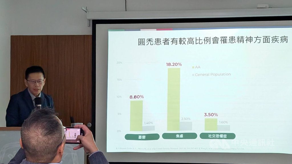 落髮別只靠換洗髮精改善 醫提醒可能是免疫疾病 落髮別只靠換洗髮精改善 醫提醒可能是免疫疾病