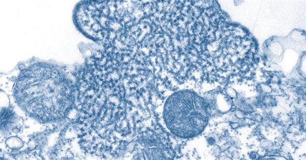 立百病毒列重點監視 疾管署評估在台感染風險低 立百病毒列重點監視 疾管署評估在台感染風險低