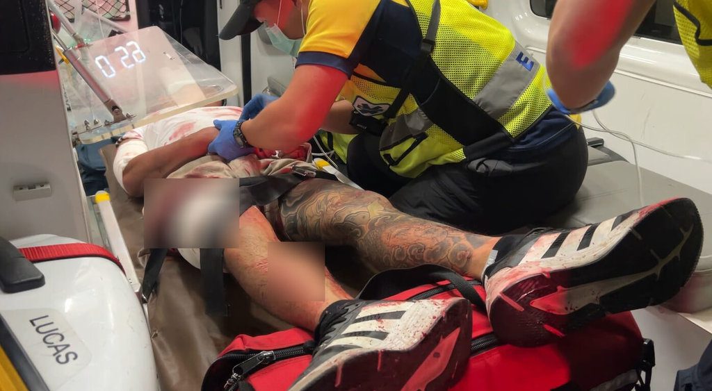 台東凌晨2幫人員械鬥 多人受槍刀傷送醫 台東凌晨2幫人員械鬥 多人受槍刀傷送醫