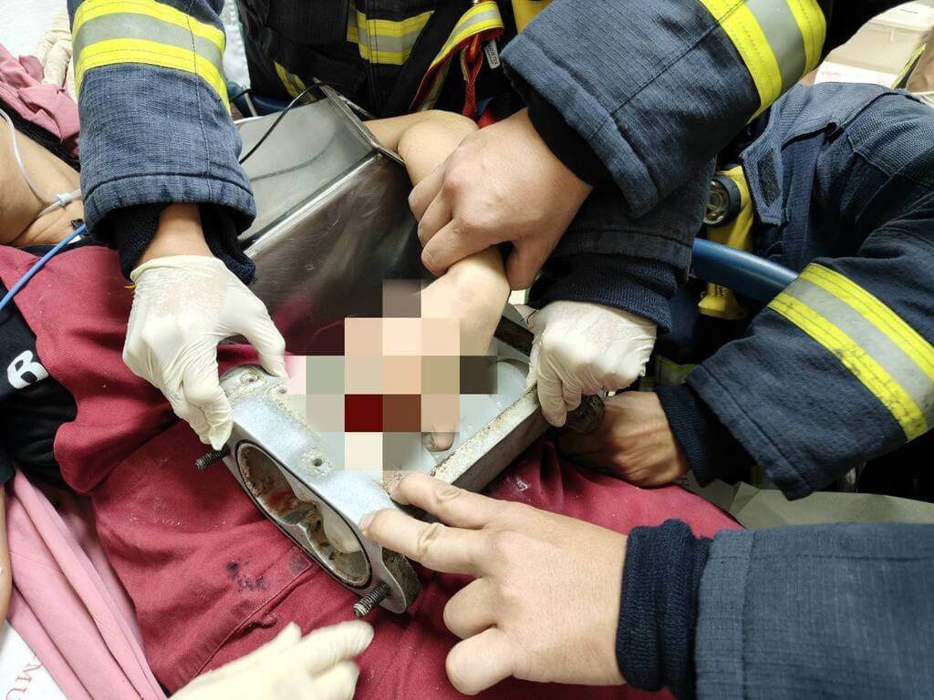 台中餅店女員工手指捲入機台 市府啟動稽查 台中餅店女員工手指捲入機台 市府啟動稽查