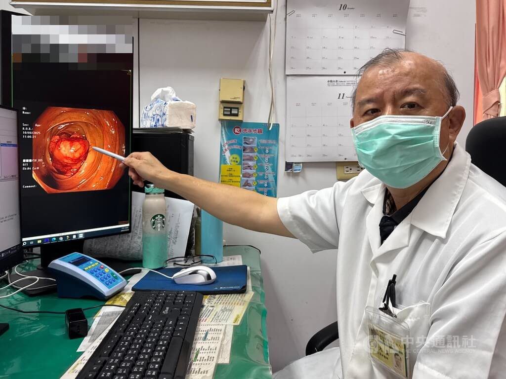 台中婦便秘血便身體虛弱送醫 檢查罹患大腸癌 台中婦便秘血便身體虛弱送醫 檢查罹患大腸癌